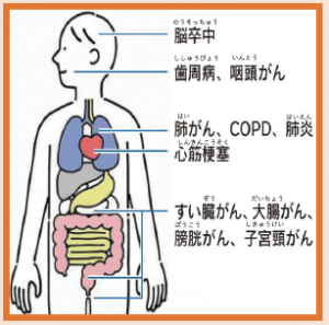 喫煙者に起こりやすい病気